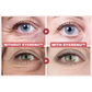 EyeRenu™ - Anti-aging PDRN Eye Cream
