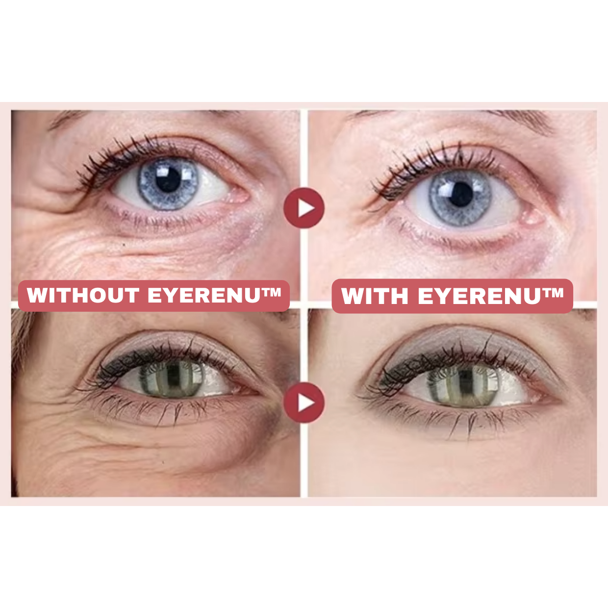 EyeRenu™ - Anti-aging PDRN Eye Cream