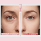 EyeRenu™ - Anti-aging PDRN Eye Cream