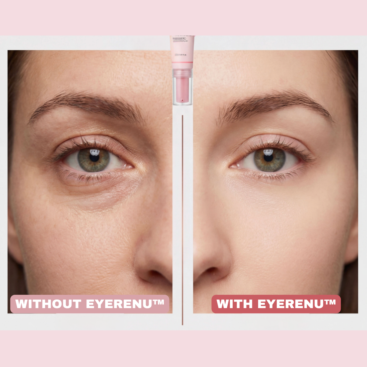 EyeRenu™ - Anti-aging PDRN Eye Cream